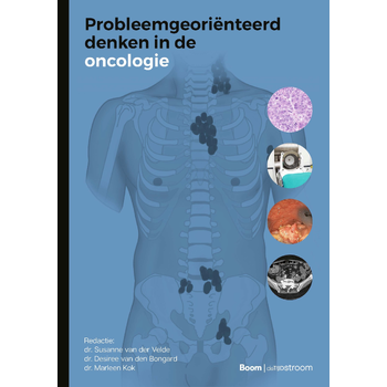 Probleemgeoriënteerd denken in de oncologie (Paperback) bij Singel 344