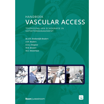 Handboek vascular access (Paperback) bij Singel 344