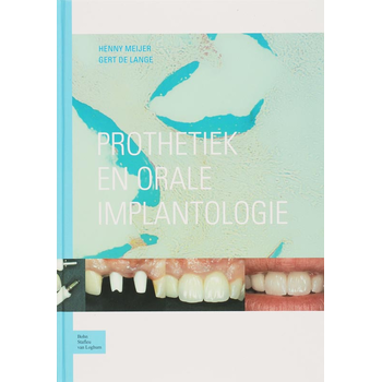 Prothetiek en orale implantologie (Hardback) bij Singel 344