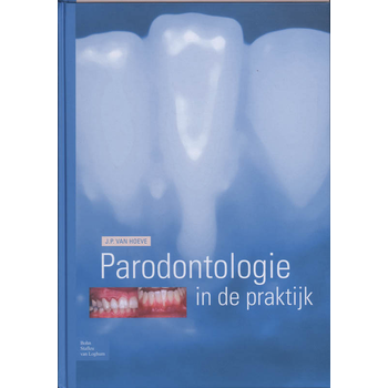 Parodontologie in de Praktijk (Hardback) van J.P. Hoeve