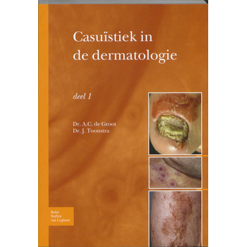 deel 1 (Paperback) bij Singel 344