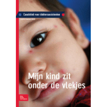 Mijn kind zit onder de vlekjes (Paperback) bij Singel 344