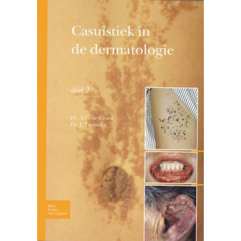 Casuïstiek in de dermatologie (Paperback) bij Singel 344
