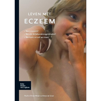 Leven met eczeem (Paperback) bij Singel 344