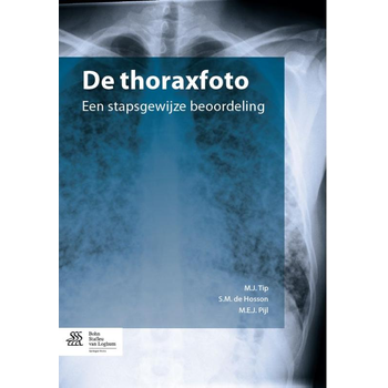 De thoraxfoto (Paperback) bij Singel 344