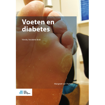 Voeten en diabetes (Paperback) bij Singel 344