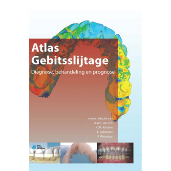 Atlas gebitsslijtage (Hardback) bij Singel 344