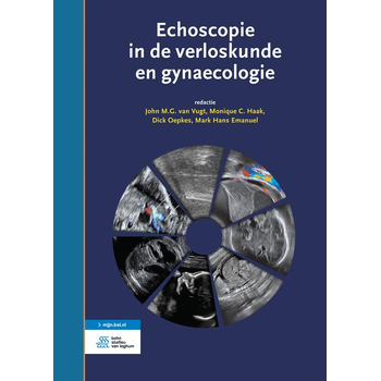 Echoscopie in de verloskunde en gynaecologie (Hardback) bij Singel 344