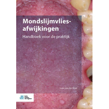 Mondslijmvliesafwijkingen (Paperback) bij Singel 344