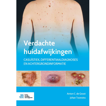 Verdachte huidafwijkingen (Paperback) bij Singel 344