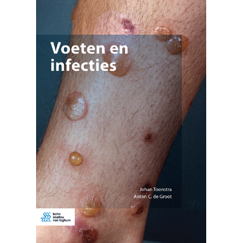 Voeten en infecties (Paperback) bij Singel 344