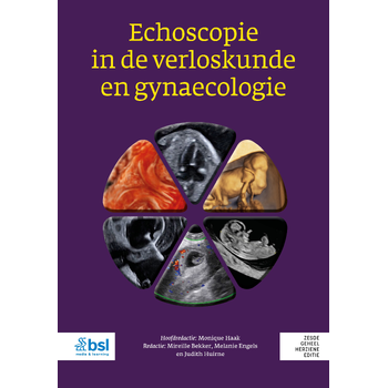 Echoscopie in de verloskunde en gynaecologie (Hardback) bij Singel 344