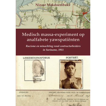 Medisch massa-experiment op analfabete yawspatiënten (Paperback) bij Singel 344