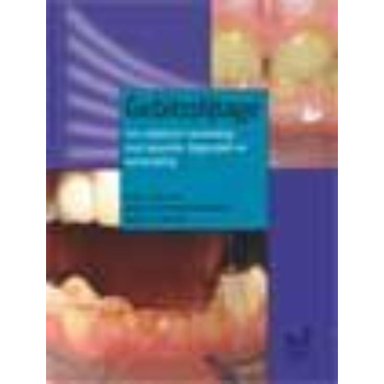 Gebitsslijtage (Hardback) bij Singel 344
