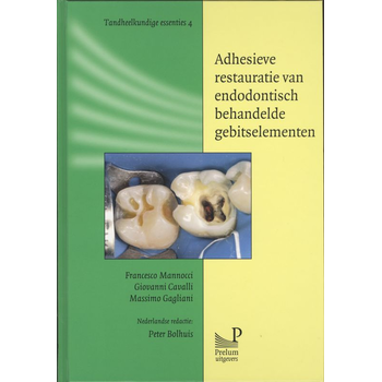 Adhesieve restauratie van endodontisch behandelde gebitselementen (Hardback) bij Singel 344