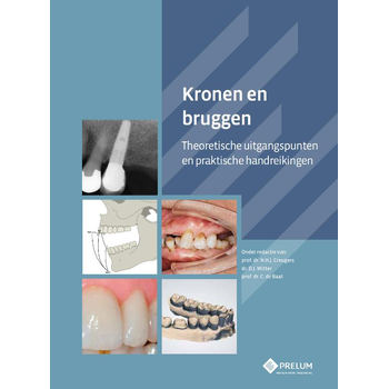 Kronen en bruggen (Paperback) bij Singel 344