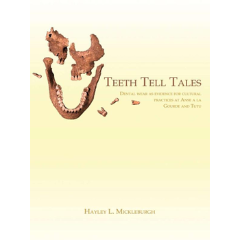 Teeth Tell Tales (Paperback) bij Singel 344
