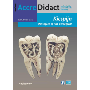 Kiespijn, dentogeen of niet-dentogeen? (Paperback) bij Singel 344