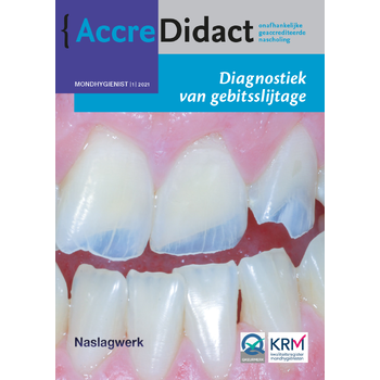 Diagnostiek van gebitsslijtage (Paperback) bij Singel 344