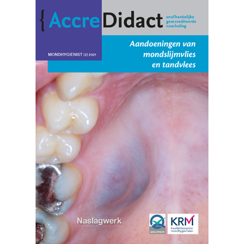 Aandoeningen van mondslijmvlies en tandvlees (Paperback) bij Singel 344
