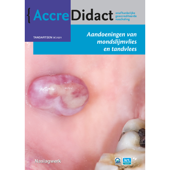 Aandoeningen van mondslijmvlies en tandvlees (Paperback) bij Singel 344