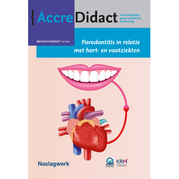 Parodontitis in relatie met hart- en vaatziekten (Paperback) bij Singel 344