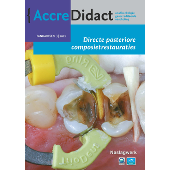 Directe posteriore composietrestauraties (Paperback) bij Singel 344