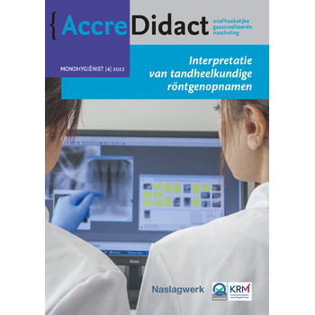 Interpretatie van tandheelkundige röntgenopnamen (Paperback) bij Singel 344