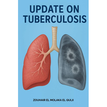 Update on tuberculosis (Paperback) bij Singel 344