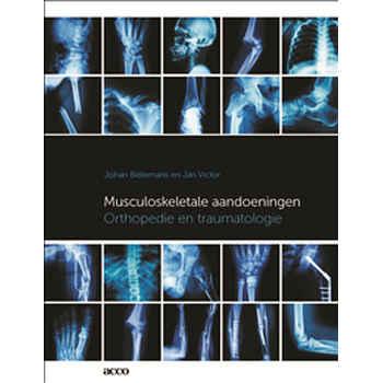 Musculoskeletale aandoeningen (Paperback) bij Singel 344