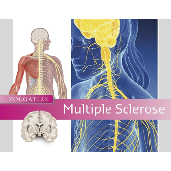 Multiple Sclerose (Hardback) bij Singel 344
