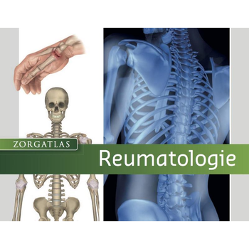 Reumatologie (Hardback) bij Singel 344