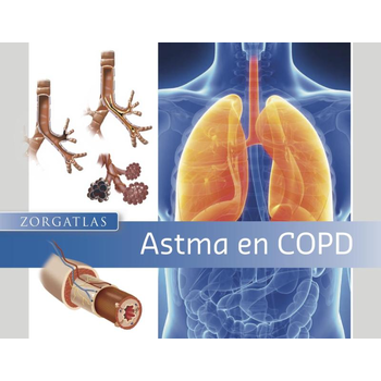 Astma en COPD (Paperback) bij Singel 344