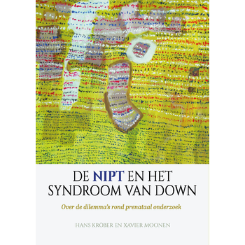 De NIPT en het syndroom van Down (Paperback) bij Singel 344